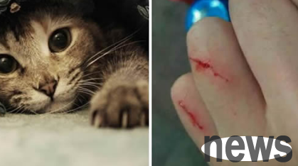 If you are scratched by a cat, do you need to get a rabies vaccine?